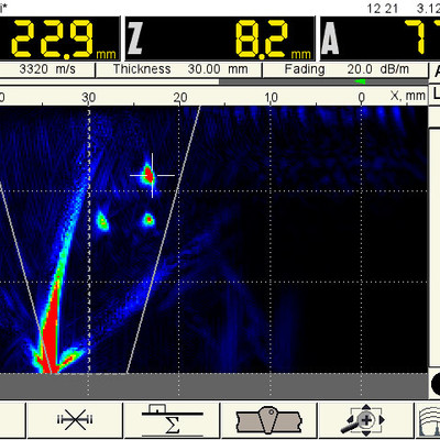 Solo B-Scan